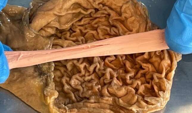 ¿Siete años en el cuerpo? Qué pasa realmente cuando nos tragamos un chicle