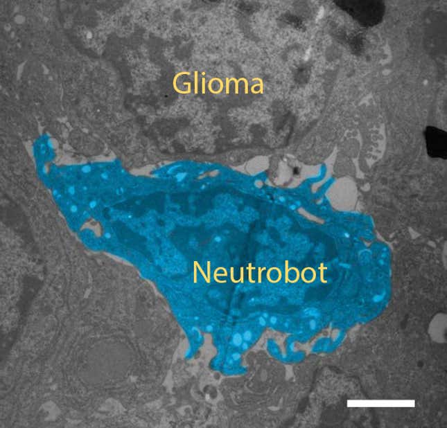 A neutrobot nestled up against a glioma tumor in a mouse brain.