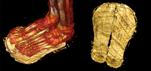 CT scans revealed sandals on the boy's feet.