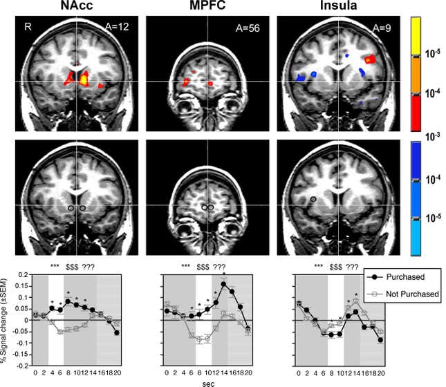 brain, shopping, purchase decisions, nucleus ambens, medial prefrontal cortex, insula, decision making, cost-benefit analysis, pain, pleasure
