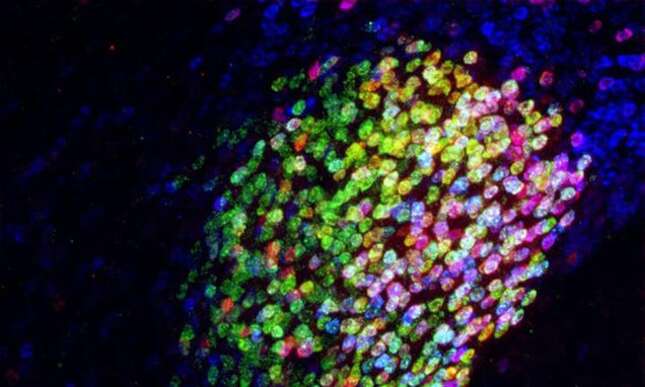 Una región del cerebro que apaga completamente el dolor en ratones podría ser una nueva fuente de terapias