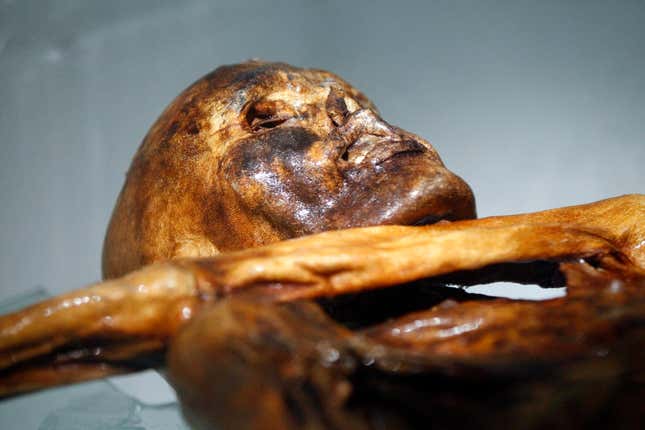 Ötzi, a 5,300-year-old mummy.