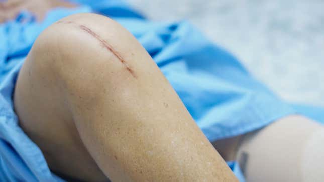 Image for article titled Common Medical Procedures And What They Cost Around The World