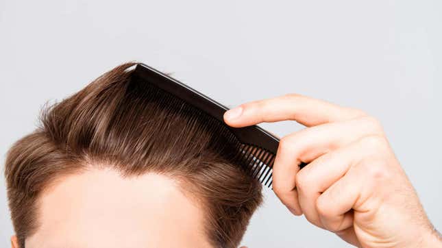 Imagen para el artículo titulado Los científicos están trabajando en tratamientos nuevos y mejorados para la pérdida del cabello