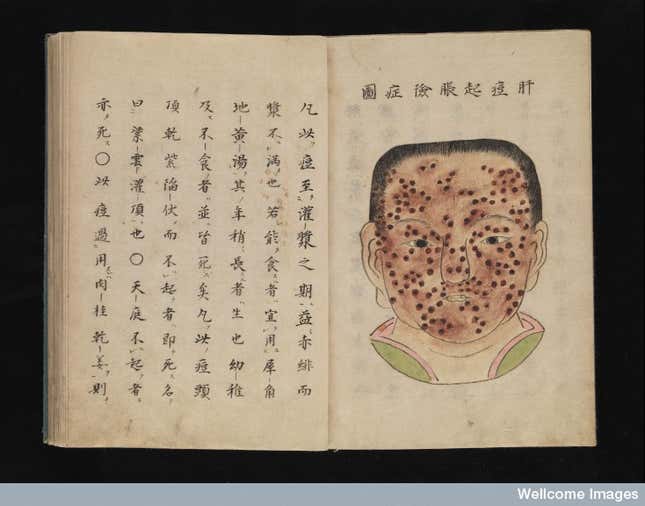 Image for article titled 'Nothing Short of Attempted Murder': A Brief History of Anti-Vaxxers