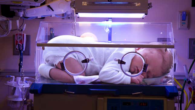 Image for article titled Horrified Nurses Discover 40-Pound Baby After Accidentally Leaving It In Incubator Over Weekend
