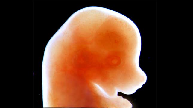 A 13-day-old mouse embryo