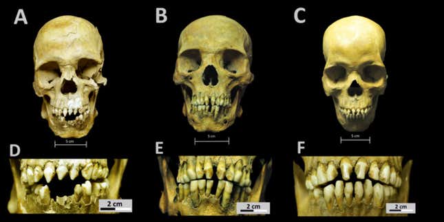 Skulls and dental decoration patterns observed on the skeletal remains.