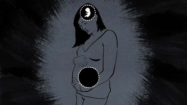 Image for article titled Ghost Child: The Strange, Misunderstood World of Delusional Pregnancy