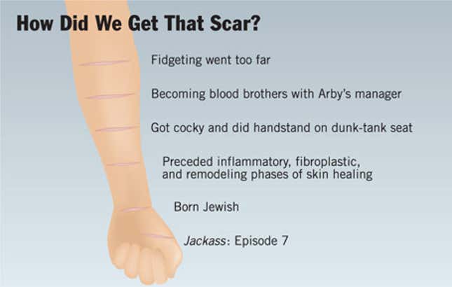 Image for article titled How Did We Get That Scar?