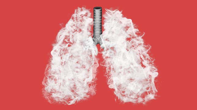 Image for article titled What Ever Happened to the Vaping Lung Disease?