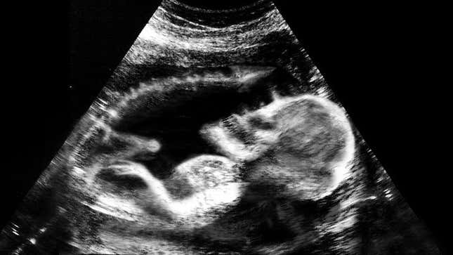 Image for article titled Royal Family Releases Kate Middleton Ultrasound Image