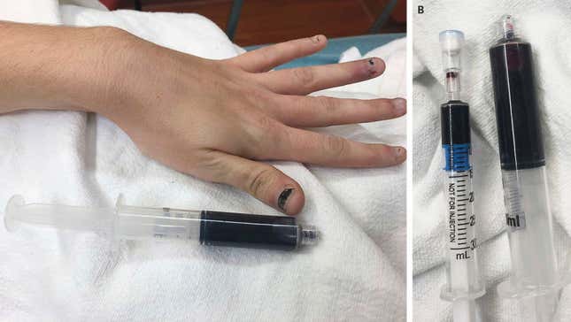 Imagen para el artículo titulado Escrotos insólitos o erecciones de 9 días: los casos que entraron a forma parte de la literatura médica en 2019