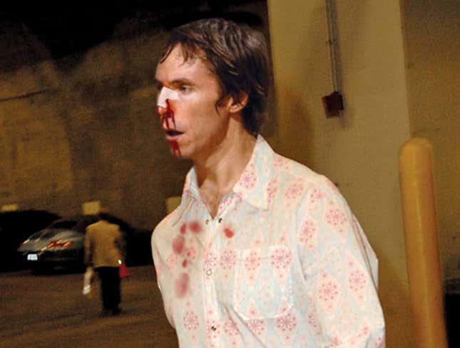 Image for article titled Steve Nash Still Bleeding