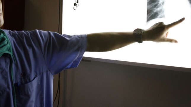 Imagen para el artículo titulado Una rara condición médica está convirtiendo el pene de este hombre en hueso