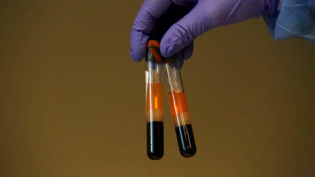 Image for article titled Does Your Blood Type Affect Your Risk of Covid-19?