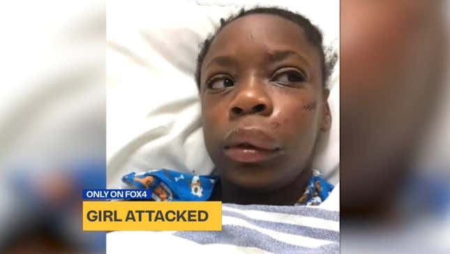Image for article titled ‘My Black Is Beautiful’: 11-Year-Old Black Girl Beaten in What Family Said Was a Racially Motivated Attack