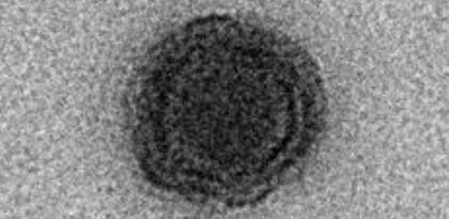 Imagen para el artículo titulado Este nuevo virus hallado en un lago de Brasil es tan extraño que el 90% de sus genes nunca se habían visto antes