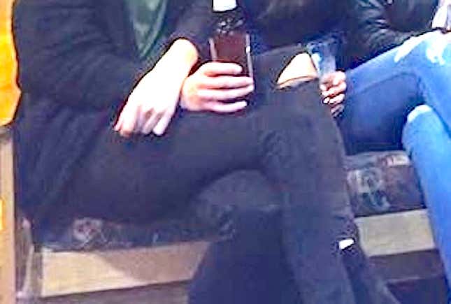 Image for article titled Where The Fuck Are This Girl's Legs?