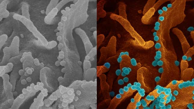 Scanning electron microscope image of viral shedding. Image on the left is the original black-and-white, while the image on the right is the colorized version. Virus particles are shown in blue. 
