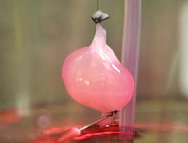 Image for article titled How We'll Finally Put An End To Organ Donation Shortages