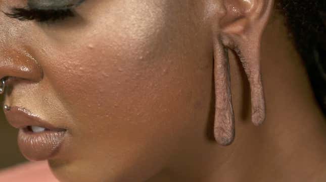 Image for article titled A Rather Unique Coming Out on Dr. Pimple Popper