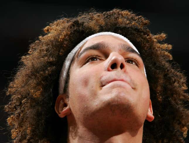 Image for article titled Anderson Varejao Tears Tendon In Hair