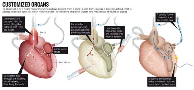 Image for article titled How We'll Finally Put An End To Organ Donation Shortages