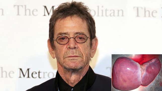 Image for article titled New Liver Complains Of Difficulty Working With Lou Reed