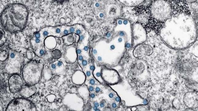Imagen para el artículo titulado Qué sabemos del estudio que afirma que el coronavirus se está volviendo más contagioso