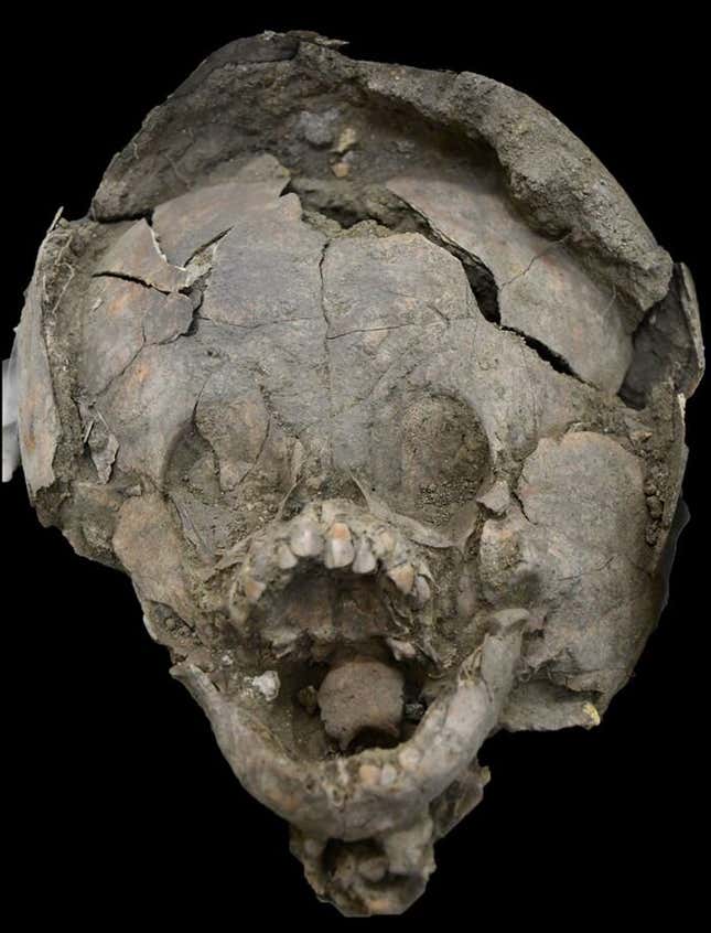 An infant skull adorned with the crania of a juvenile individual.