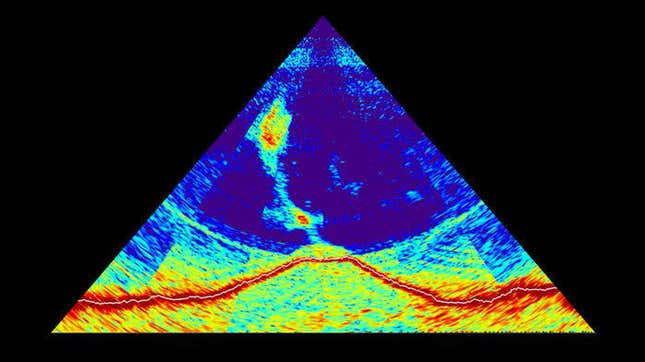 Sonar image of the new volcano.