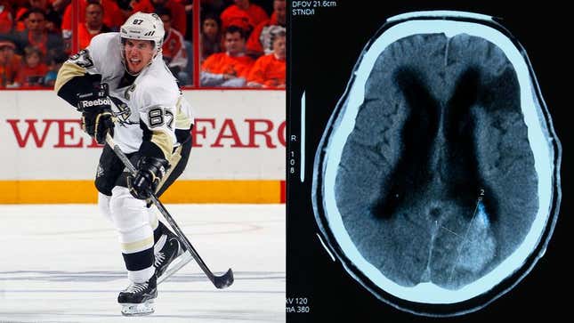 Image for article titled Return Of NHL Season Reignites Exciting Sidney Crosby Vs. Cranial Fluid Buildup Rivalry