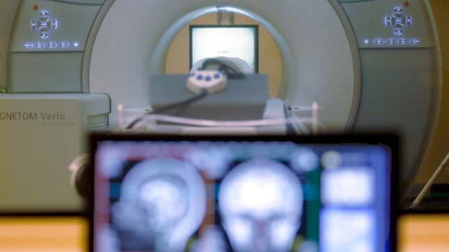 File photo of an fMRI brain scanner. 