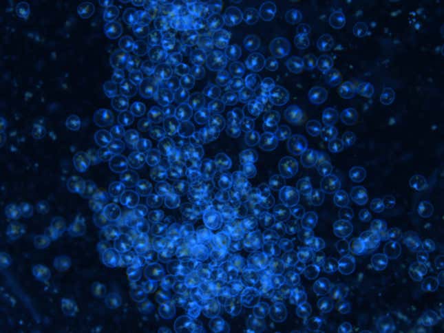 Cells of red Noctiluca scintillans seen glowing blue under a microscope.