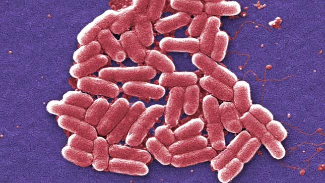 E. coli bacteria.