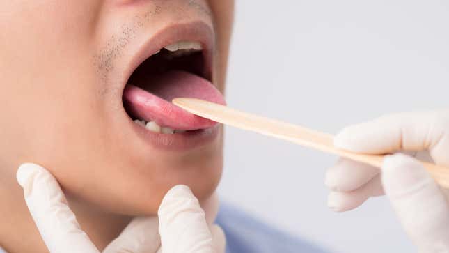 Image for article titled Doctors Excited to Find &#39;Rare&#39; Forked Uvula in Florida Man