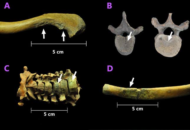 Joint and bone damage found on the skeletal remains: (A) extensive bone wear, (B) signs of hernia on a vertebrae, (C and D) greenish coloration as evidence of a copper bullet.