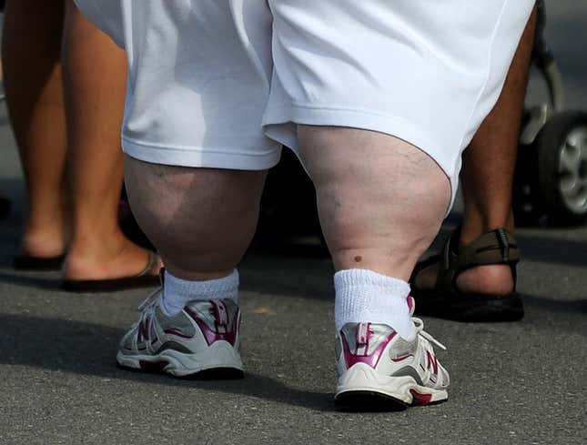 Image for article titled Obese Man Has Amazing Calves