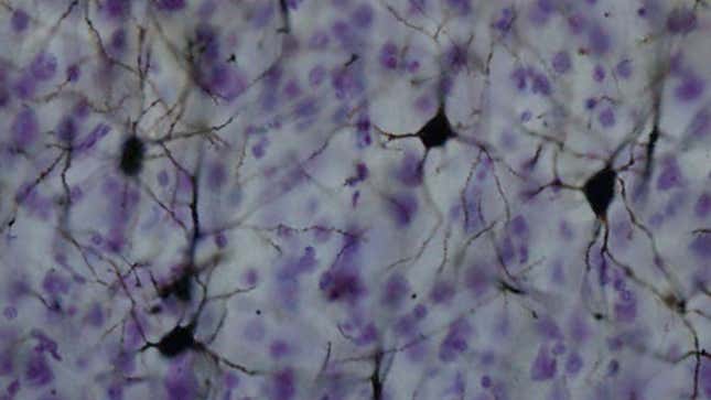 Stained macaque neurons