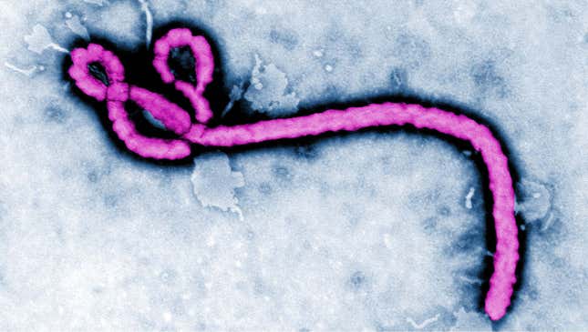 Image for article titled What You Need To Know About Ebola