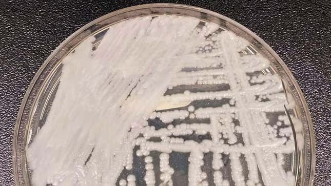 A strain of Candida auris being cultured in a petri dish at a CDC laboratory.