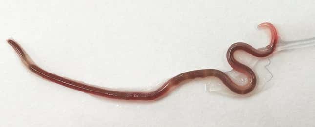 Imagen para el artículo titulado Encuentran este gusano de 38 milímetros en la amígdala de una mujer que comió sashimi