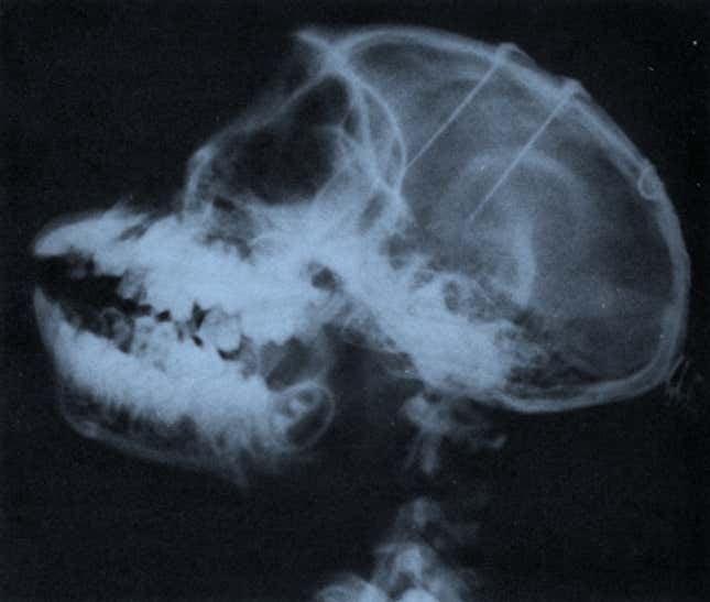 An X-ray of a monkey’s head in which neuroscientist Jose Delgado implanted electrodes arrays in the frontal lobes and the thalamus. Image: Physical Control of the Mind by Jose Delgado.