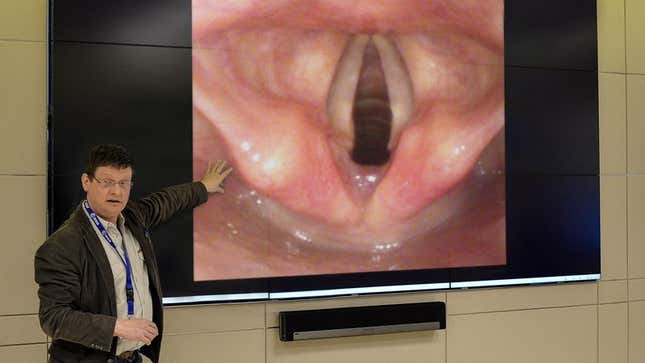 Image for article titled Scientists Find Human Vocal Cords Developed Over Millennia To Lower Voice When Speculating On Acquaintance’s Sexual Orientation