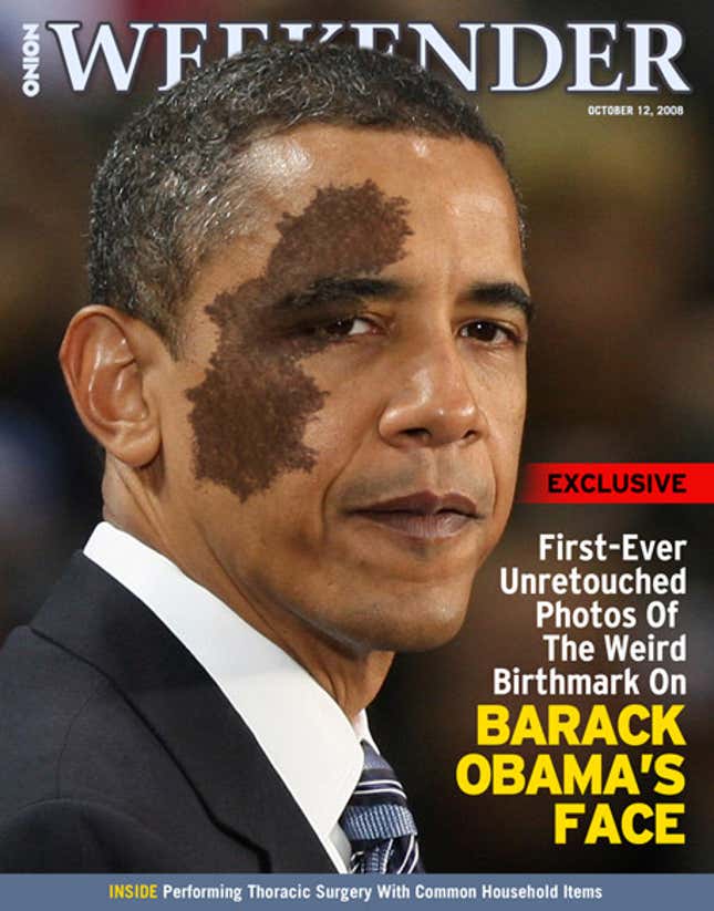 Image for article titled First-Ever Untouched Photos Of The Weird Birthmark On Barack Obama&#39;s Face