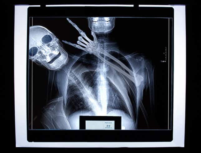 Image for article titled Buddy Sneaks Into Chest X-Ray