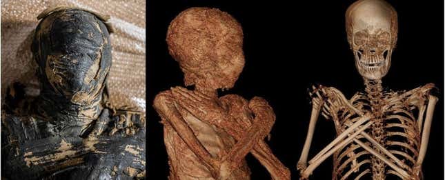 Imágenes y escaneos de la momia