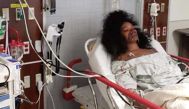 Imagen para el artículo titulado Una mujer termina en la sala de urgencias después de que el hospital creyera que su maquillaje de zombie era real