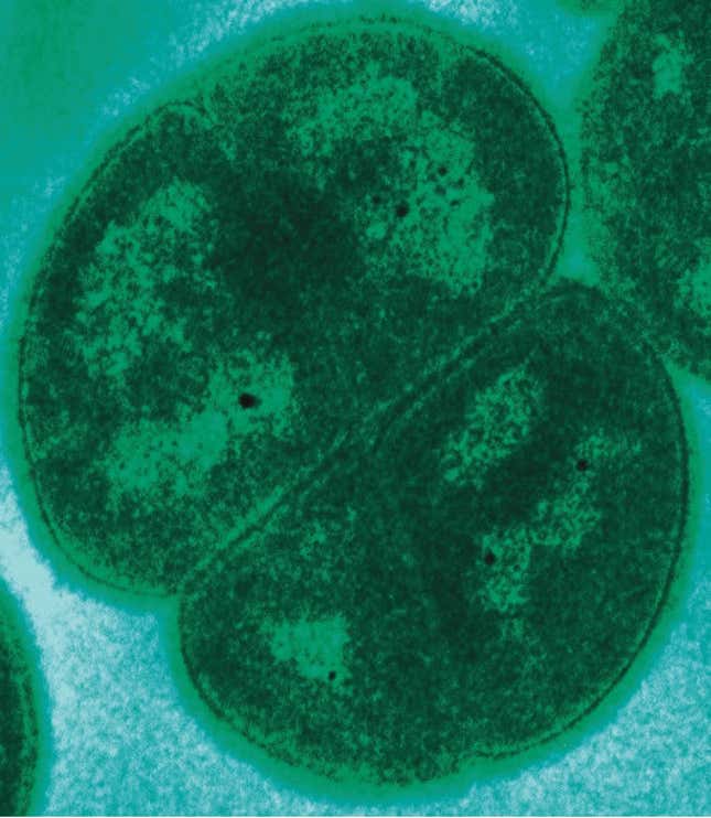 Transmission electron microgragh of Deinococcus radiodurans